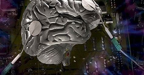 Neuralink